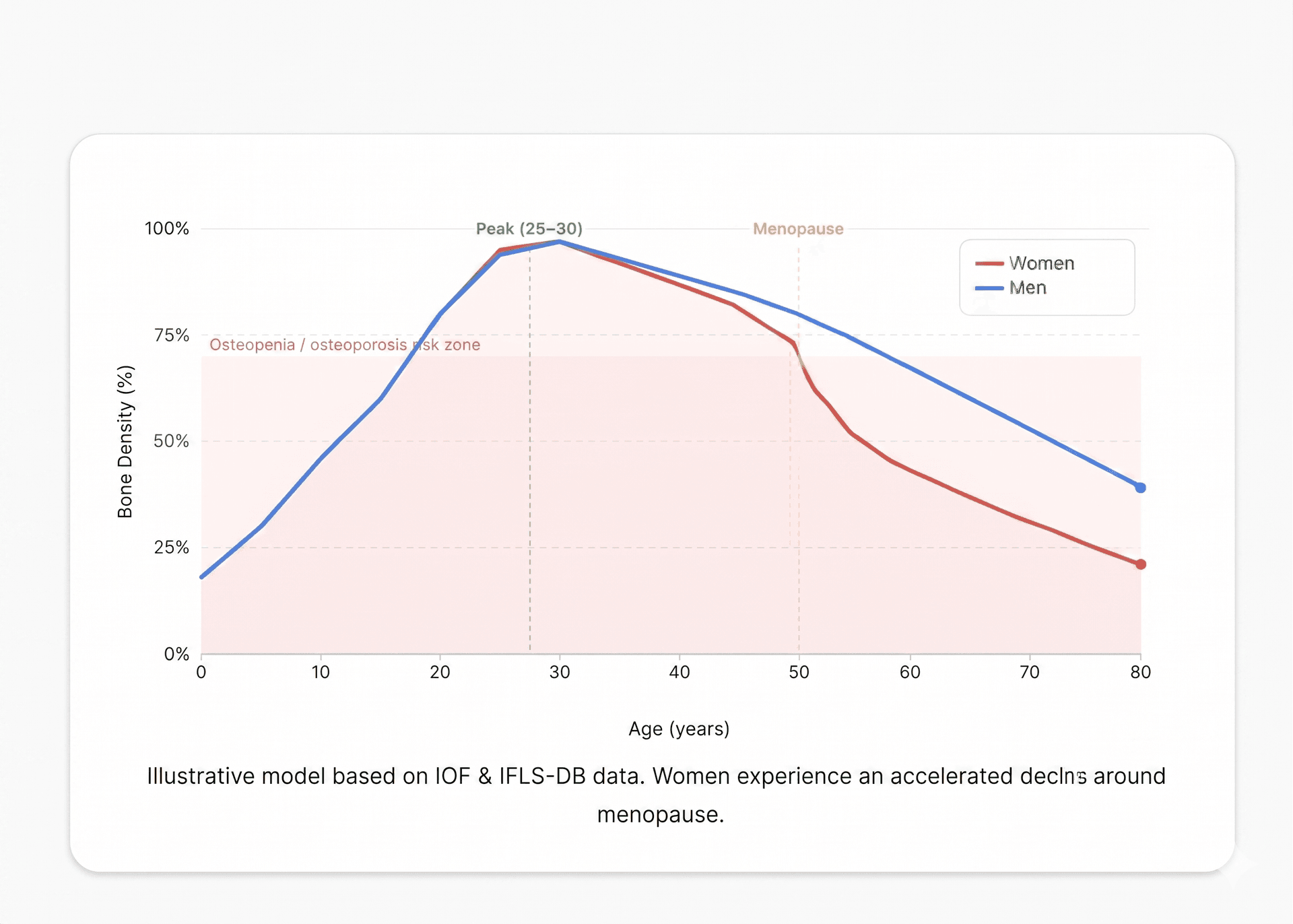 Graph showing how bone density changes over a lifetime for men and women, with a sharp decline in women after menopause