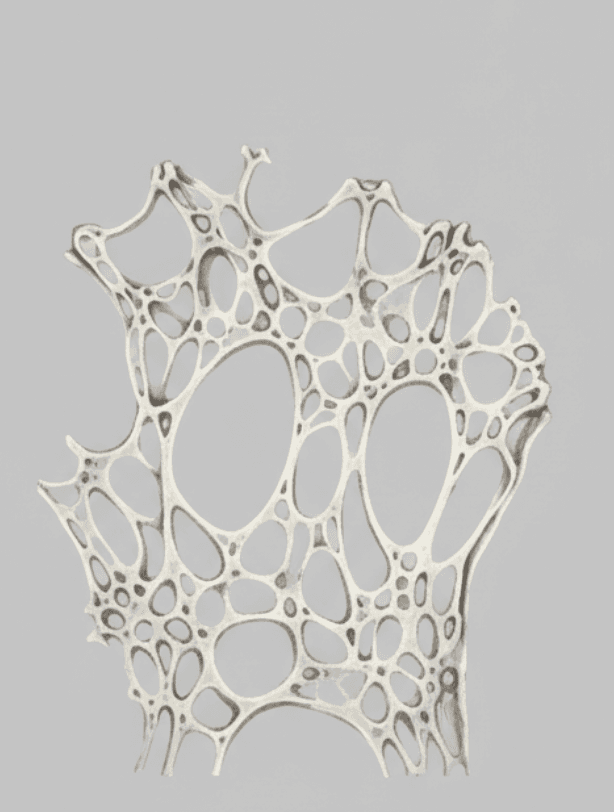 Microscopy image of osteoporotic bone showing large gaps and thinned, weakened structure